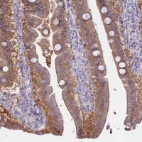 Anti-AHCYL1 antibody produced in rabbit HPA042589-100UL