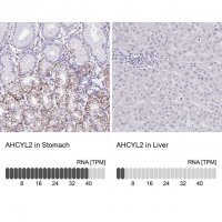 Anti-AHCYL2 antibody produced in rabbit 