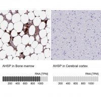 Anti-AHSP antibody produced in rabbit 