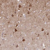 Anti-AK5 antibody produced in rabbit 