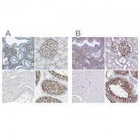 Anti-AKAP12 antibody produced in rabbit
