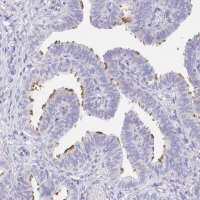 Anti-AKAP14 antibody produced in rabbit 