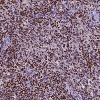 Anti-AKAP17A antibody produced in rabbit