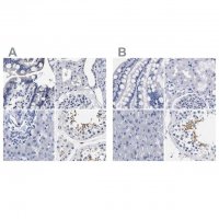 Anti-AKAP4 antibody produced in rabbit