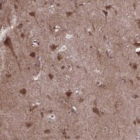 Anti-AKAP5 antibody produced in rabbit