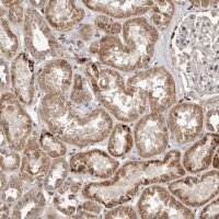 Anti-AKAP7 antibody produced in rabbit 