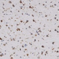 Anti-AKAP9 antibody produced in rabbit 