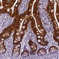 Anti-AKR1B10 antibody produced in rabbit