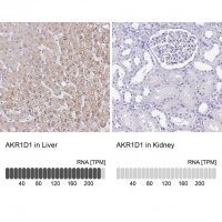 Anti-AKR1D1 antibody produced in rabbit HPA057002-100UL