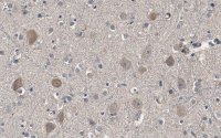 Anti-Akt Antibody, PH Domain Antibody, clone SKB1 ZooMAb� Mouse Monoclonal 