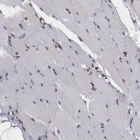 Anti-AKT1 antibody produced in rabbit 
