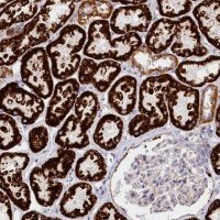 Anti-AKTIP antibody produced in rabbit