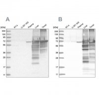Anti-ALB antibody produced in rabbit