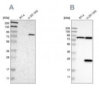 Anti-ALDH18A1 antibody produced in rabbit