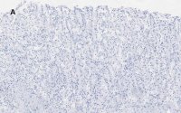 Anti-ALDH1A1 Antibody, clone 4J6, ZooMAb� Rabbit Monoclonal 