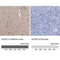 Anti-ALDOC antibody produced in rabbit 