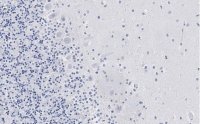 Anti-Aldolase C Antibody, clone 3B18, ZooMAb� Rabbit Monoclonal 