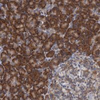 Anti-ALG2 antibody produced in rabbit