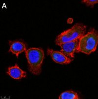 Anti-ALK-7 Antibody, clone 1N5 ZooMAb� Rabbit Monoclonal 