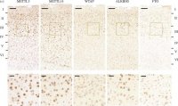 Anti-ALKBH5 antibody produced in rabbit 