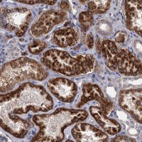 Anti-ALKBH7 antibody produced in rabbit 