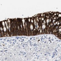 Anti-ALOX15 antibody produced in rabbit