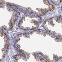 Anti-ALOX15B antibody produced in rabbit