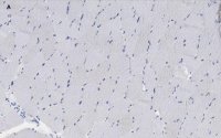 Anti-alpha Actinin 2 Antibody, clone 1E11, ZooMAb� Rabbit Monoclonal 