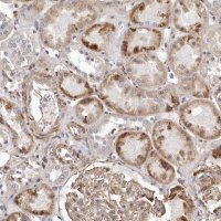 Anti-ALPK1 antibody produced in rabbit