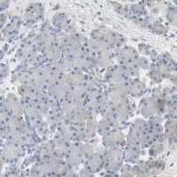 Anti-ALPL antibody produced in rabbit 