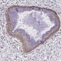 ANTI-ALX1 antibody produced in rabbit 
