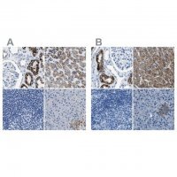 Anti-AMACR antibody produced in rabbit 
