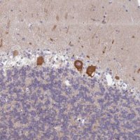 Anti-AMPD2 antibody produced in rabbit