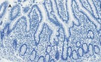 Anti-AMPK alpha Antibody, clone 2D22, ZooMAb� Rabbit Monoclonal 