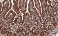Anti-AMPK alpha Antibody, clone 2D22, ZooMAb� Rabbit Monoclonal 