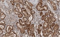 Anti-Angiotensinogen Antibody, clone 1B12 ZooMAb� Rabbit Monoclonal 