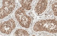 Anti-Anillin Antibody, clone 2C6 ZooMAb� Rabbit Monoclonal 