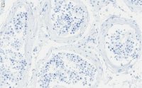 Anti-Anillin Antibody, clone 2C6 ZooMAb� Rabbit Monoclonal 