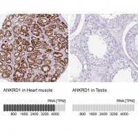 Anti-ANKRD1 antibody produced in rabbit 
