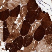 Anti-ANKRD2 antibody produced in rabbit