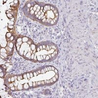 Anti-ANKRD29 antibody produced in rabbit