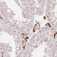 Anti-ANKRD31 antibody produced in rabbit