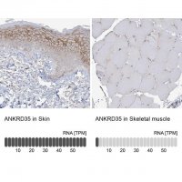 Anti-ANKRD35 antibody produced in rabbit 