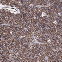 Anti-ANKRD37 antibody produced in rabbit 