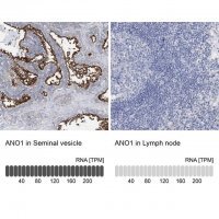 Anti-ANO1 antibody produced in rabbit 