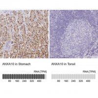 Anti-ANXA10 antibody produced in rabbit 