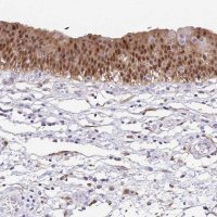 Anti-ANXA10 antibody produced in rabbit 