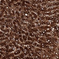 Anti-AOX1 antibody produced in rabbit 