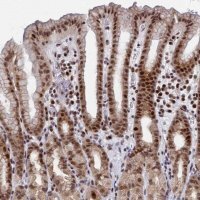 Anti-AP5Z1 antibody produced in rabbit 