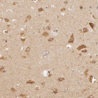 Anti-APP antibody produced in rabbit